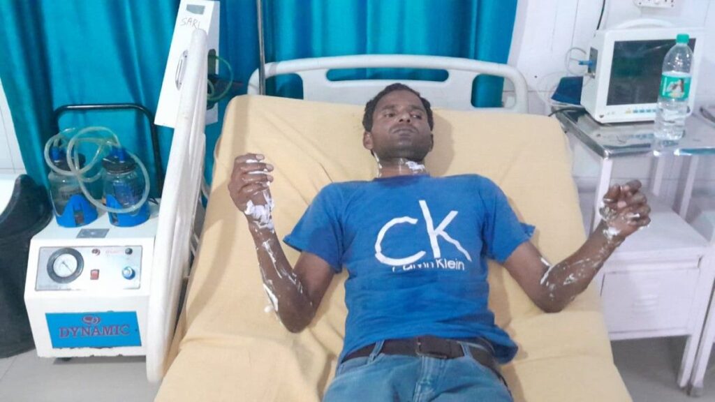 मुरादाबाद की एकता कॉलोनी में गैस सिलेंडर से लगी आग का दृश्य।